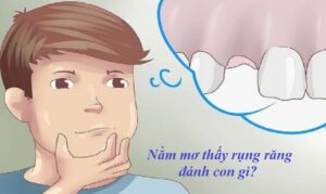 Mơ gãy răng đánh lô con gì? Giải mã điềm báo và số may mắn