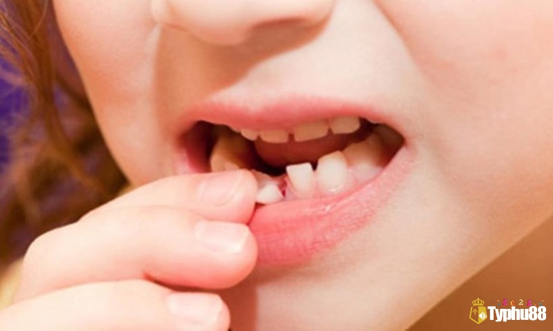 Trong văn hóa dân gian Việt Nam, giấc mơ gãy răng mang nhiều ý nghĩa khác nhau tùy thuộc vào hoàn cảnh cụ thể
